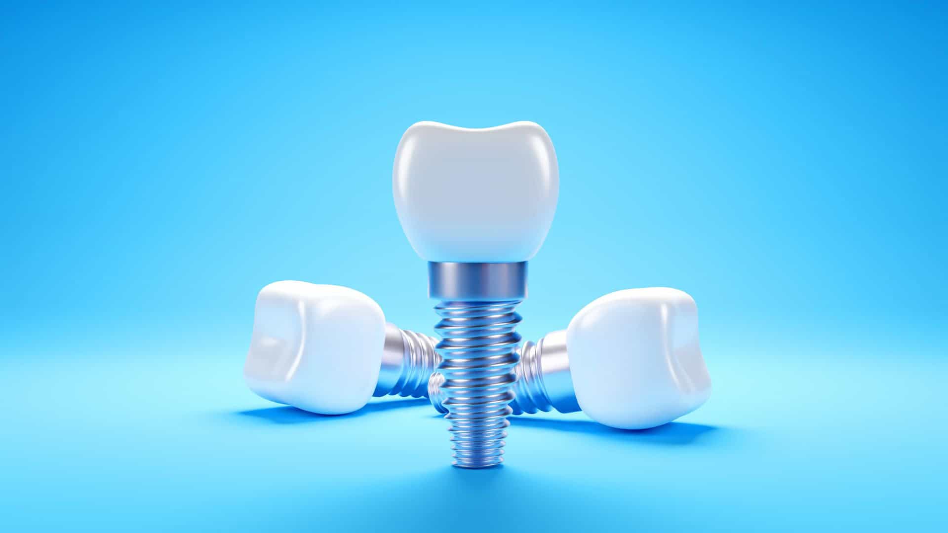 a dental implants on a blue background